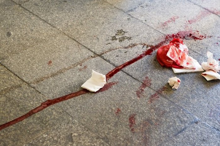 Ilustračný obrázok k článku Krvavý útok nožom: Ochrankár zranil takmer 40 detí, zaútočil aj na riaditeľa školy