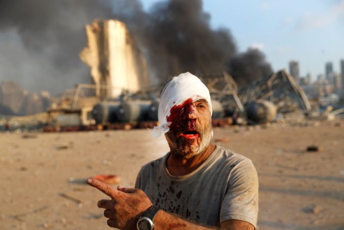Ilustračný obrázok k článku Mŕtvoly v uliciach Bejrútu a tisícky zranených! Čo spôsobilo ohnivé peklo v Libanone? FOTO